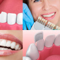 The Difference Between Smile Makeovers and Cosmetic Dentistry