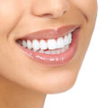 The Most Affordable Smile Makeover: 3 Amazing Options