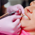 Can I Get a Smile Makeover if I Have Gum Disease?