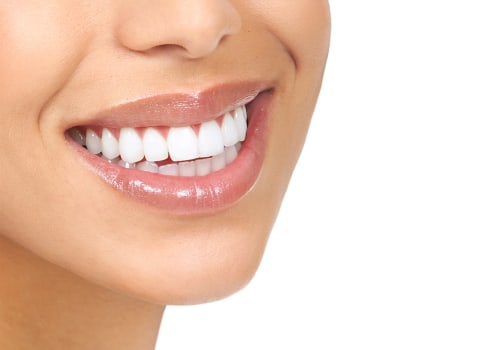 Smile Makeover: A Comprehensive Guide to Cost and Healing Time