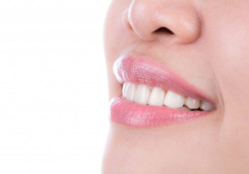 Smile Makeover: A Comprehensive Guide to Transform Your Smile